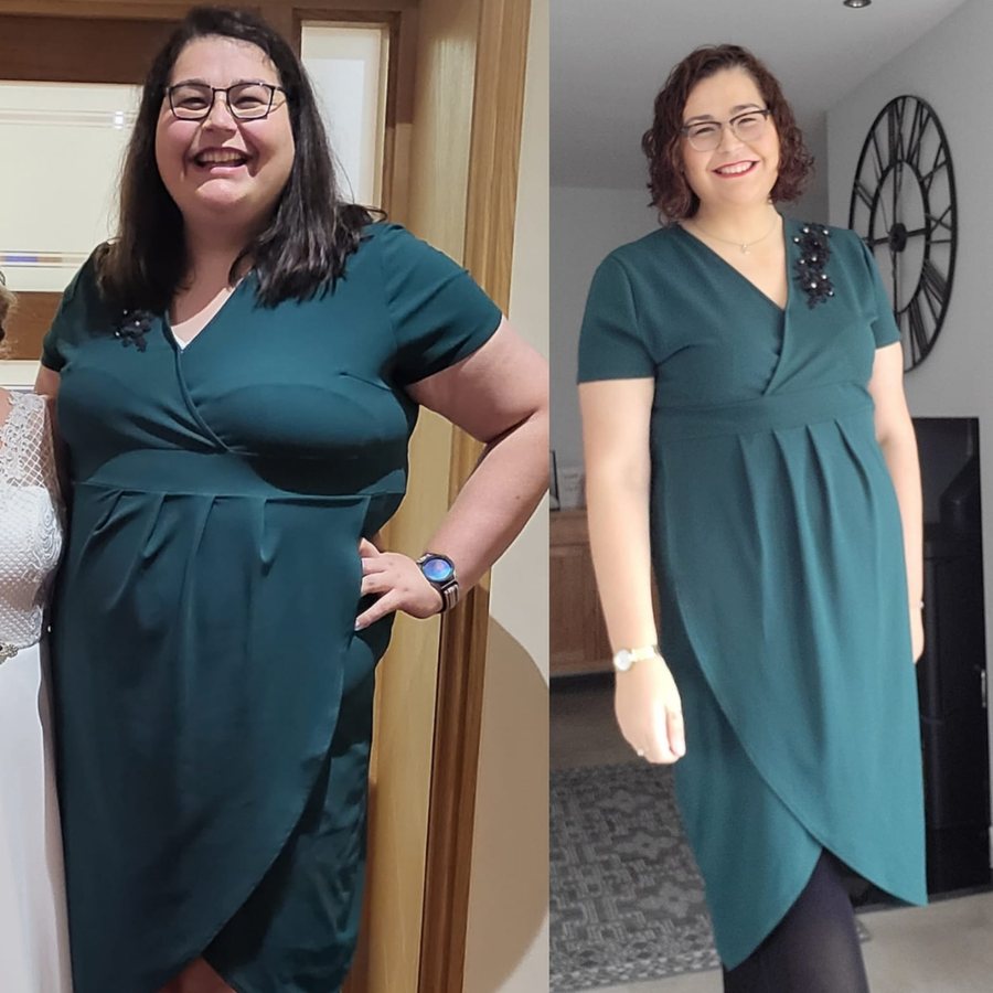Rachel before and after, wearing the same green dress, visibly transformed