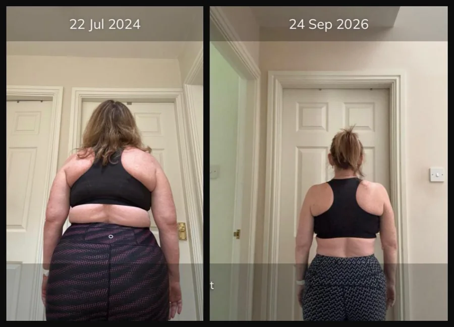 Two photographs of the same client from behind, dated 22 July 2024 and 24 September 2026, markedly smaller in the second